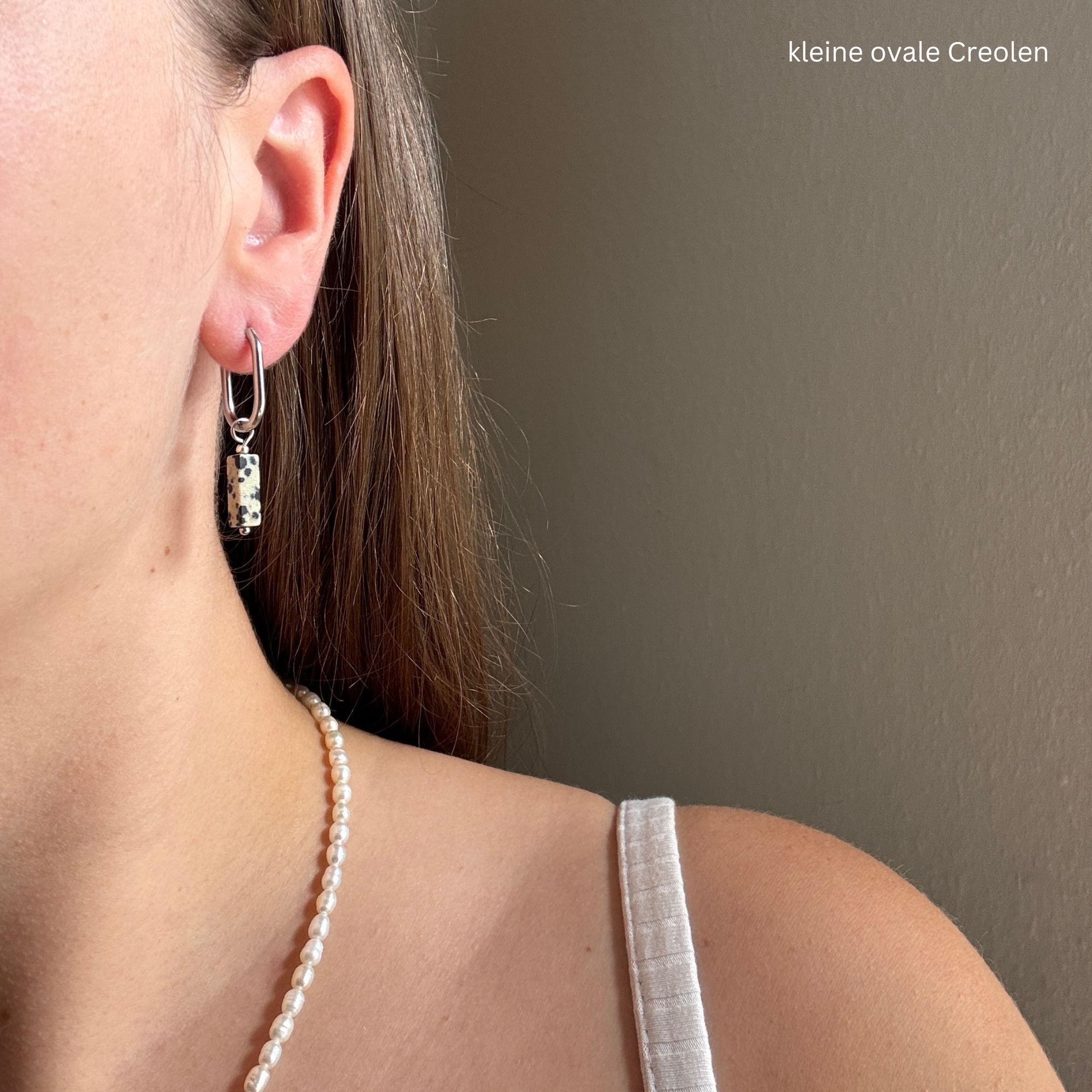 dalmatiner#Farbe_Silber