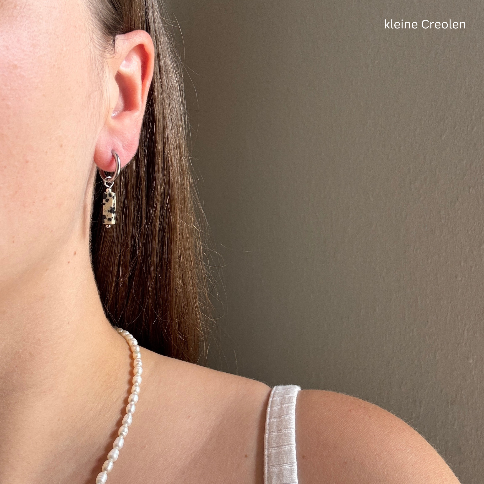 dalmatiner#Farbe_Silber