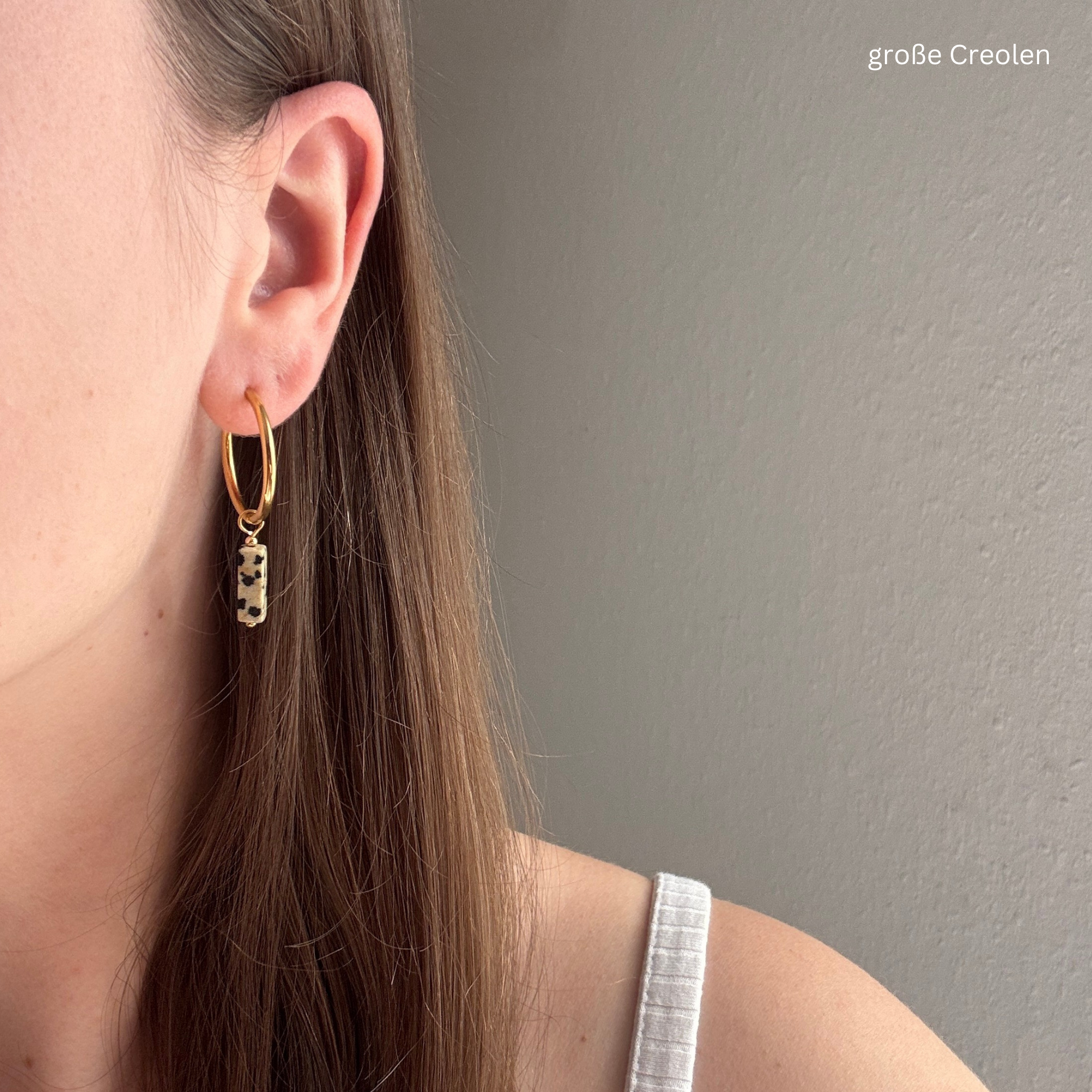 dalmatiner#Farbe_Gold